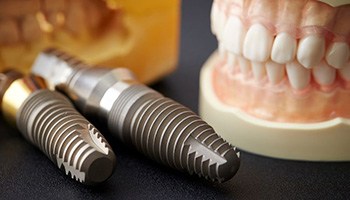 Enlarged dental implant models next to artificial teeth