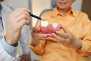 Dentist pointing to a dental implant mold